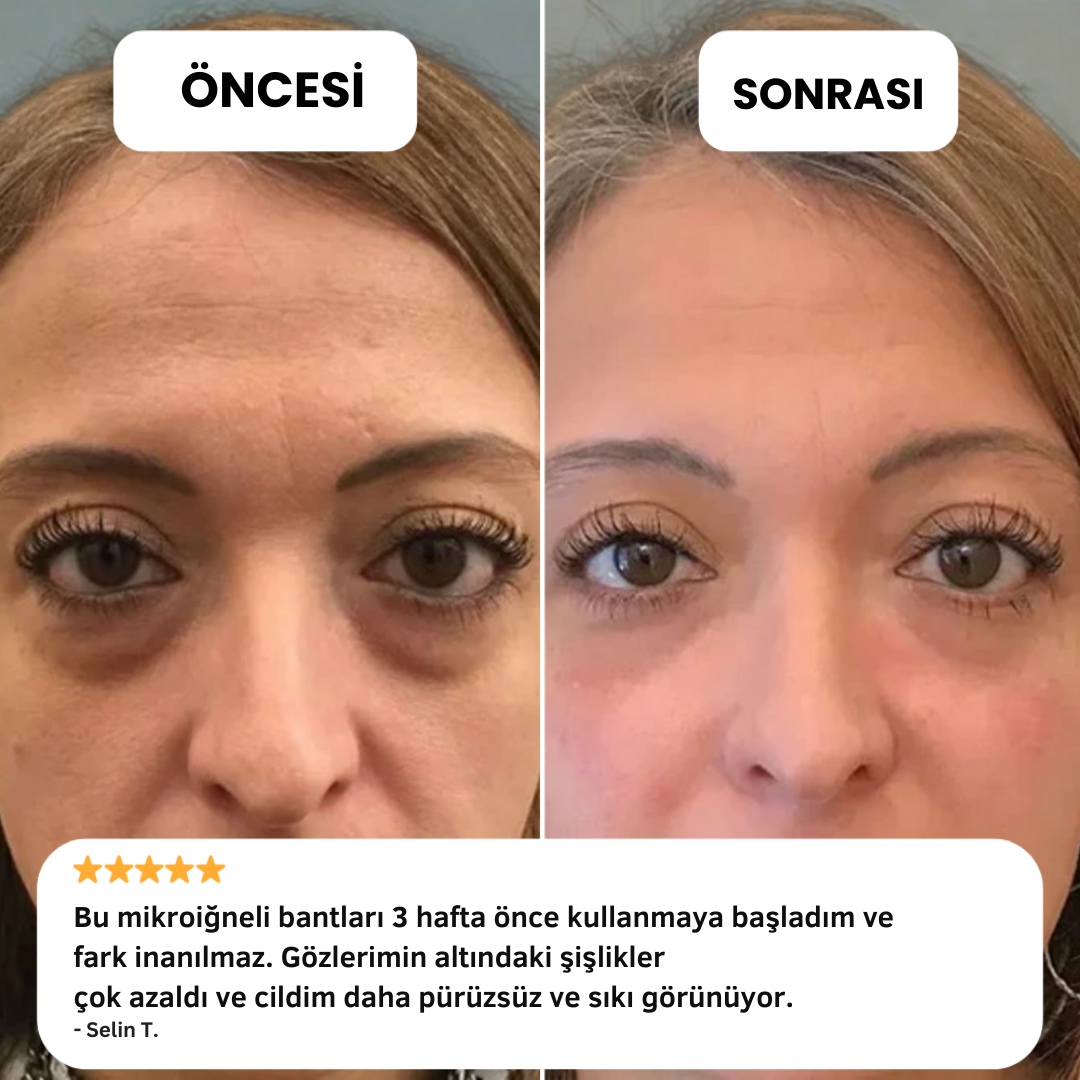 GlowEye Microneedle Göz Altı Bandı